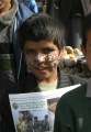 Kabuler Junge mit Hautgeschwueren.jpg
